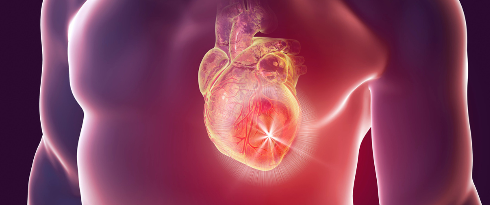 Tetralogy of Fallot Repair